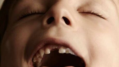 orofacial-myology-child-cannot-put-tongue-to-spot