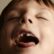 orofacial-myology-child-cannot-put-tongue-to-spot